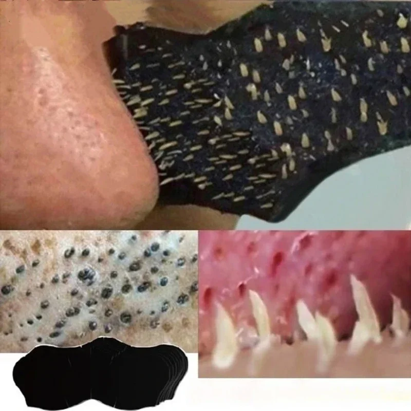 Charcoal Pore Strip - Masque unisexe pour éliminer les points