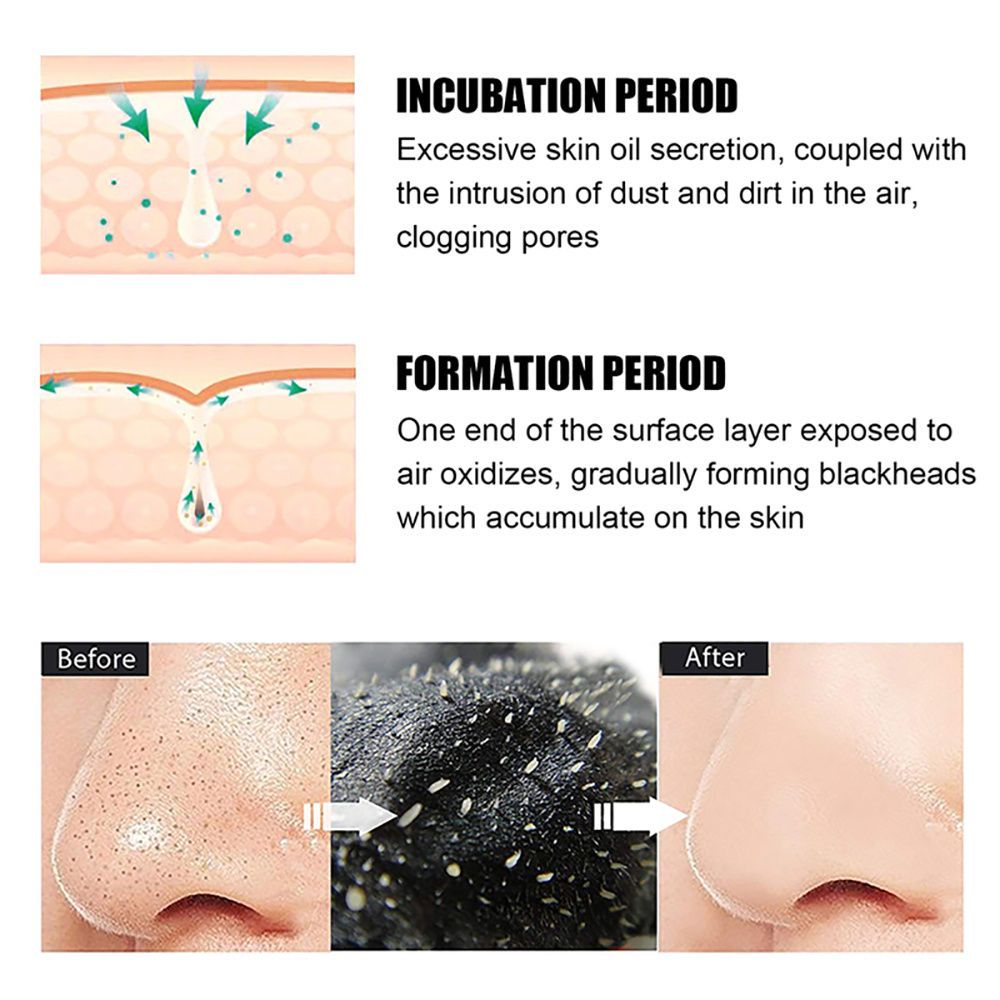 Masque dissolvant de points no - Charcoal Pore Strip avis et prix