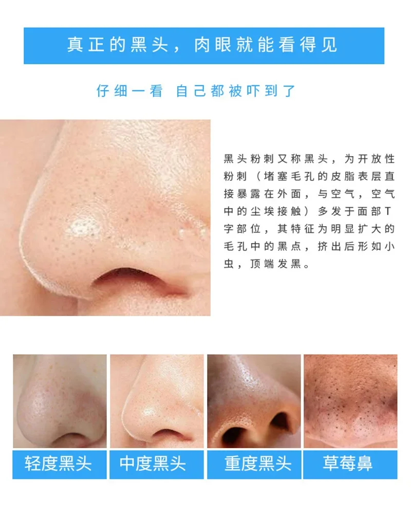 Bandes nasales au charbon de b - Charcoal Pore Strip avis et prix