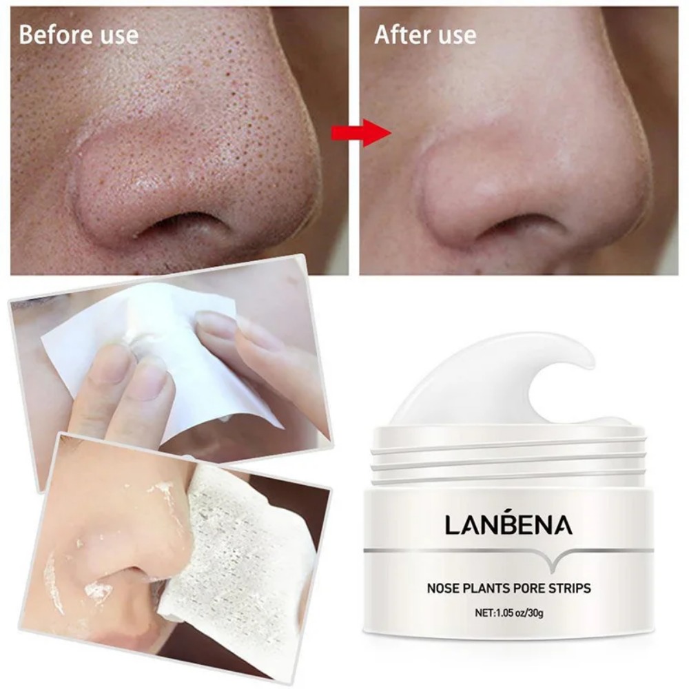 Crème dissolvant de points noi - Charcoal Pore Strip avis et prix