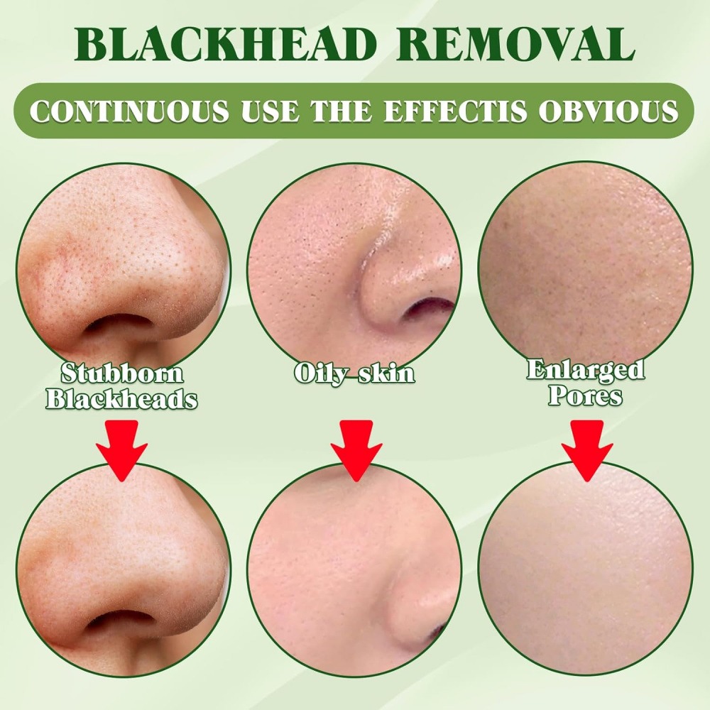 15 bandes nettoyantes pour poi - Charcoal Pore Strip avis et prix